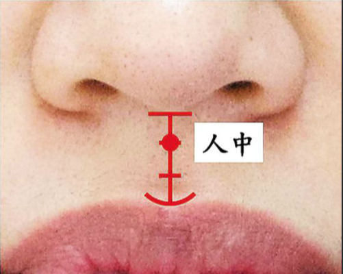 1,有子也难见人中一条线,有子也难见是中国民间面相对人中浅平女性的